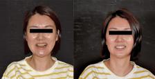 微笑模擬1