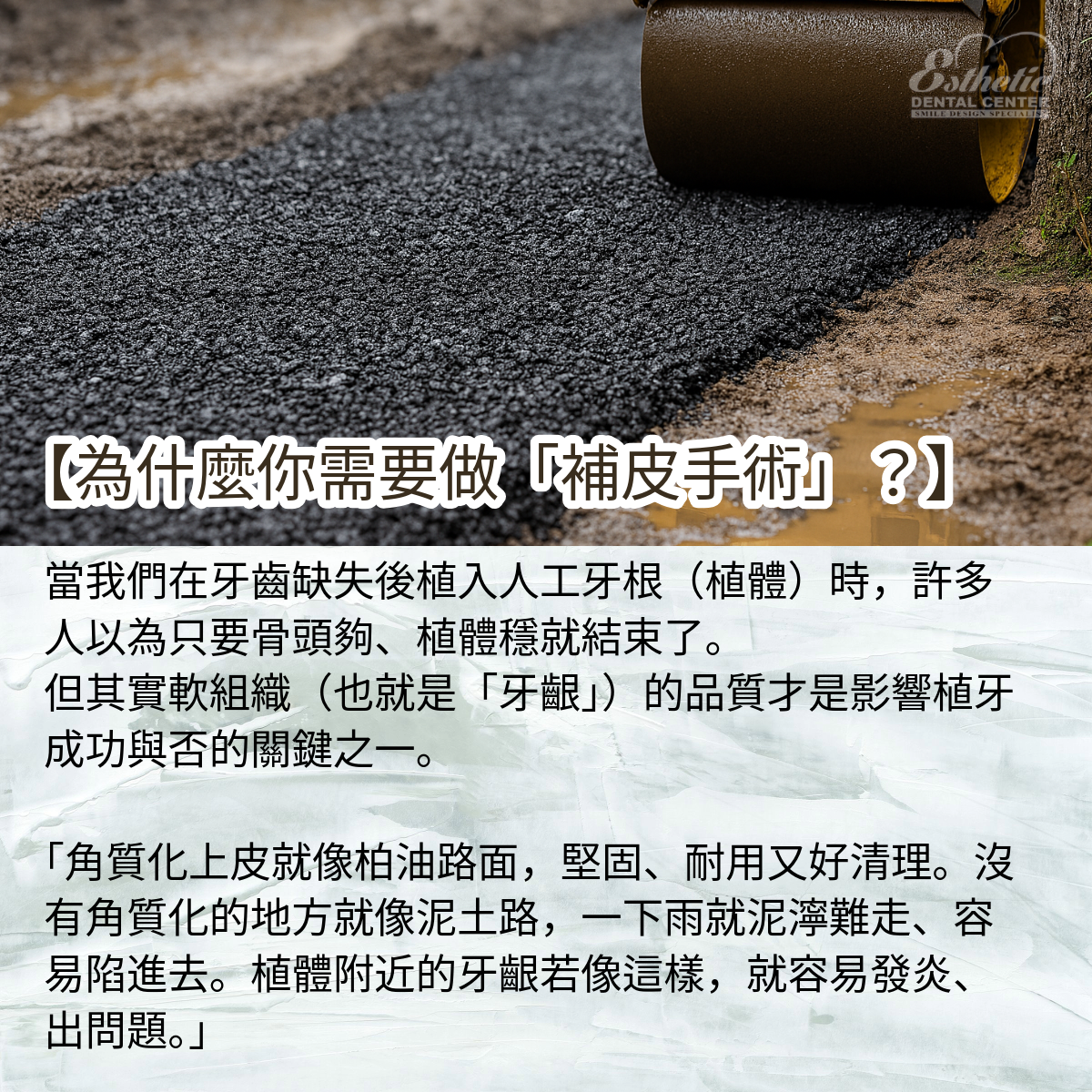 補皮是什麼?