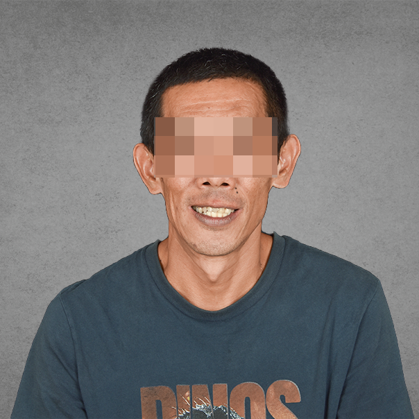 權泓牙醫Locator鈕扣式假牙案例分享